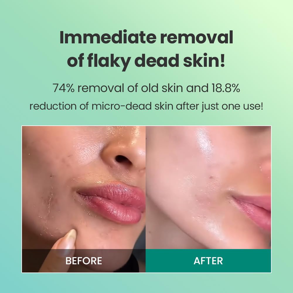 Dr.G Brightening Peeling Gel (120ml)