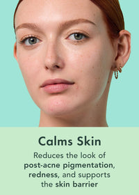 Thumbnail for Rael Serum for Face – Miracle Clear Serum with Salicylic Acid, Niacinamide, Zinc, Pore Minimizer, Korean Skin Care (1 fl oz)