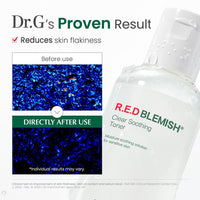 Thumbnail for Dr. G R.E.D. Blemish Clear Soothing Toner - Korean Soothing Toner for Glowing Skin - Soothes Irritation Clear Skin - Mild Exfoliant - with AHA, BHA & Centella Asiatica - 10.14 fl oz
