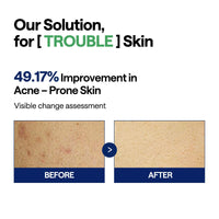 Thumbnail for MEDIHEAL Teatree Trouble Facial Toner Pads with Tea Tree & Lactobacillus - Calming & Soothing for Sensitive & Acne Prone Skin - Vegan Face Gauze, 100 Pads