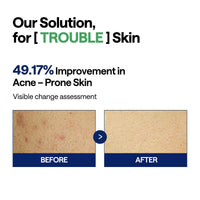 Thumbnail for MEDIHEAL Teatree Trouble Pad - Square Cotton Facial Toner Pads with Tea Tree & Lactobacillus - Soothing to Calm Sensitive & Acne Prone Skin- Vegan Face Gauze 100