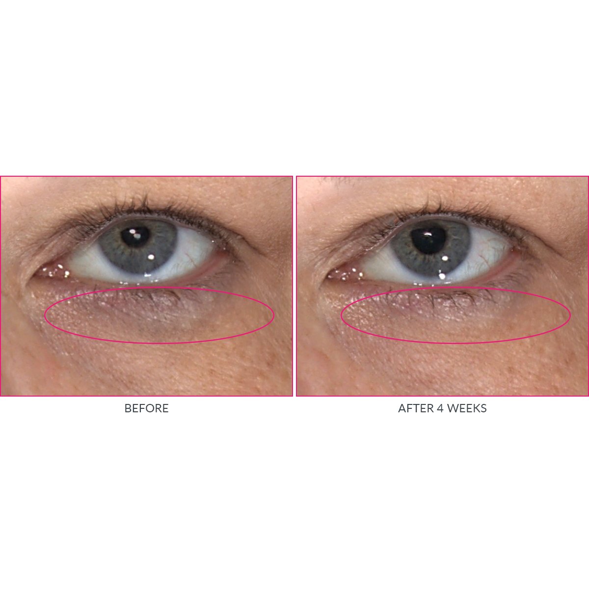 Kate Somerville Wrinkle Warrior Eye Gel | Visible Dark Circle Eraser | Instantly Plumps & Hydrates Under Eye Skin | 0.3 Fl Oz