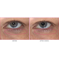 Thumbnail for Kate Somerville Wrinkle Warrior Eye Gel | Visible Dark Circle Eraser | Instantly Plumps & Hydrates Under Eye Skin | 0.3 Fl Oz
