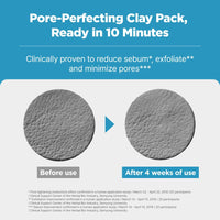 Thumbnail for ISOI Pore Tightening Clay Mask for Face, Natural Kaolin & Plant-Based Formula for Tightening, Lifting, Exfoliating & Sebum Control, Moisture-Balancing, Korean Clay Mask for Pores (3.38 fl. oz, 100ml)
