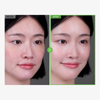 Thumbnail for TOSOWOONG Kakadu Plum Blemish Cream, Dark Spot Remover for Face Cream, Kakadu Plum 600,000ppm, Niacinamide, Adenosine, Betaine, Dark Spot Corrector, Vitamin C, Korean Skin Care, 50g, 1.76 oz.