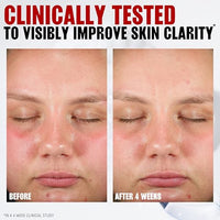 Thumbnail for Image 3 of THAYERS Pore Refining Toner Pads, Dual-Sided Exfoliating Pads, 60 Count