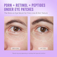 Thumbnail for Image 5 of AILEORY PDRN Retinol Peptides Under Eye Patches - 24 Pairs
