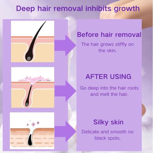 Image 6 of PHOFAY Cloud Sense Hair Removal Spray for Women & Men (2PC, Depilatory Cream)