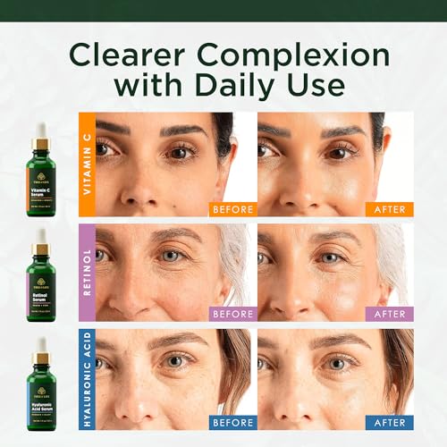 Image 7 of Tree of Life Face Serum Skin Care, Facial Serum for Women and Men, Set of 3