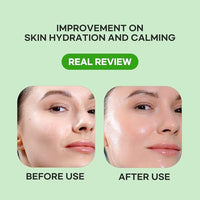 Thumbnail for Image 3 of Epielle Heartleaf Calming Serum Sheet Masks (5pk)