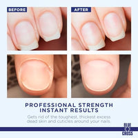 Thumbnail for Image 7 of Blue Cross Cuticle Remover & Softener with Lanolin for Nails