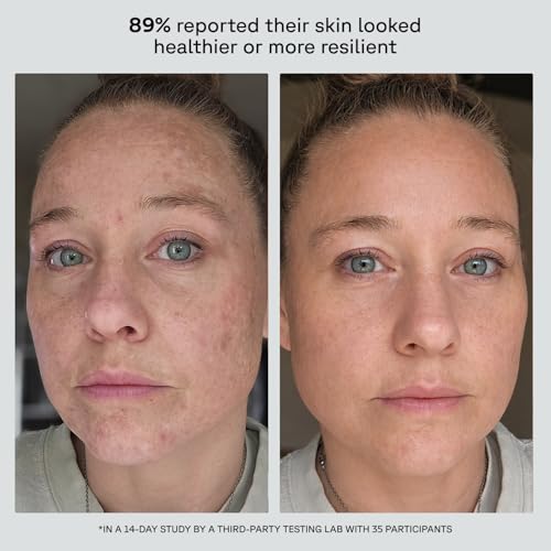 Image 7 of Acure Future Fusion PM Face Moisturizer - With Retinol - 1.7 fl oz