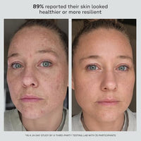 Thumbnail for Image 7 of Acure Future Fusion PM Face Moisturizer - With Retinol - 1.7 fl oz