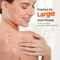 Thumbnail for Image 6 of TKTK Large Pimple Patches for Face & Body