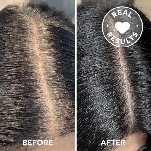 Image 12 of Madison Reed Root Perfection Root Touch-Up Kit