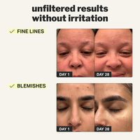 Thumbnail for Cocokind Beginner Retinol Gel 0.1%, Improve the Appearance of Fine Lines and Uneven Texture without Irritation, Aloe and Cica to Prevent Dryness, 1 fl oz