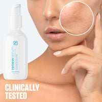 Thumbnail for BRIOTECH Skin Serum, Hypochlorous Acid Mineral Serum, Soften Fine Lines, Smooth Face Neck Chest, Spot Corrector, Soothe Dry Red Skin, 2 fl oz ea, 2 ct