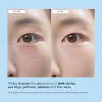 Thumbnail for Terez & Honor Under Eye Patches for Dark Circles - 60 Korean Hydrogel Masks for Puffiness, Bags, Wrinkle with Caffeine, Hyaluronic Acid, Niacinamide - Undereye Hydrating & Cooling, Vegan, No Fragrance