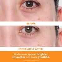 Thumbnail for Peter Thomas Roth | Potent-C™ Power Brightening Hydra-Gel Eye Patches | Eye Mask Patches for Under-Eye Bags and Fine Lines | Brightens The Look of Dark Circles