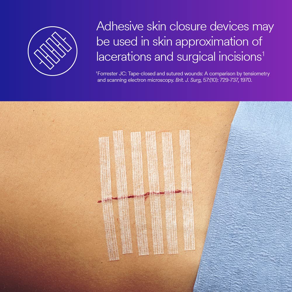 3M™ Steri-Strip™ Reinforced Adhesive Skin Closures, R1547, 1/2 in x 4 in (12 mm x 100 mm), 50 Bag/Carton, 4 Carton/Case