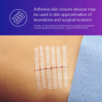 Thumbnail for 3M™ Steri-Strip™ Reinforced Adhesive Skin Closures, R1547, 1/2 in x 4 in (12 mm x 100 mm), 50 Bag/Carton, 4 Carton/Case