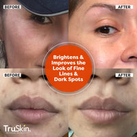 Thumbnail for TruSkin Vitamin C Serum For Face – Anti Aging Formula with Vitamin C, Hyaluronic Acid, Vitamin E – Brightening Serum – Improve Appearance of Dark Spots, Tone, Fine Lines & Wrinkles, 2 Fl Oz