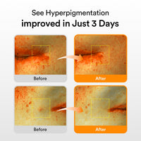 Thumbnail for Abib Glutathiosome Dark Spot Serum Vita drop 1.69 fl.oz. | Korean Skincare, Dark Spot, Hyperpigmentation Treatment | Serum for Sensitive, Uneven Skin