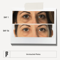 Thumbnail for RODAN + FIELDS Active Hydration Bright Eye Complex | 15ml | Moisturizing Under Eye Cream for Dry Skin | Eye Treatment for Refreshed Appearance | Skincare