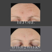 Thumbnail for Kate Somerville KateCeuticals Firming Serum | Advanced Anti-Aging Plumping & Firming Treatment | 1 Fl Oz