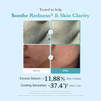 Thumbnail for medicube Azelaic Acid Niacinamide Clarifying Toner | Troubled Skin Care, Ideal for Purifying & Calming | 4% Azelaic Acid & 2% Niacinamide| Soothing Daily Toner | Korean Skin Care | 8.45 fl.oz