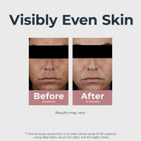 Thumbnail for Eucerin Radiant Tone Dual Serum Dark Spot Corrector, Dark Spot Serum with Thiamidol and Hyaluronic Acid, Helps Visibly Reduce the Look of Persistent Dark Spots, 1 Fl Oz Bottle