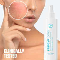 Thumbnail for BRIOTECH Skin Renew Toner, Hypochlorous Acid Spray Topical Skin Spray for Face and Skin, Minimize Appearance of Blemishes, Soothing Mist for Redness & Bumps, 4 fl oz