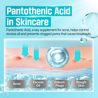 Thumbnail for numbuzin No.1 Serum | Pantothenic B5 Active Soothing Serum | Soothing, Hydrating | Pantothenic Acid, Niacinamide | Excess Oil Control, Reduces Breakouts, Acne | Oily, Acne-Prone Skin | 1.69 fl. oz.