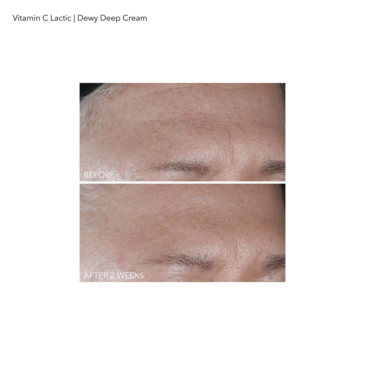 Dr Dennis Gross Vitamin C Plus Lactic Dewy Deep Cream Cream Unisex 2 oz