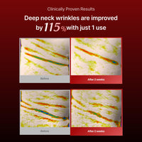 Thumbnail for Wrinkle-fit Neck Mask - Neck Wrinkle Patches, Firming and Tightening Korean Deep Collagen Mask - Hyaluronic Acid NeckTargeted Mesh Sheet Mask for Lifting Sagging Skin - Boosting Elasticity 7EA
