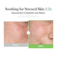 Thumbnail for medicube Exosome Cica Tea Tree Cream for Sensitive Skin with Centella Asiatica help reduce redness and breakouts. | Low-irritating, Moisturizing Daily Texture Care | Korean Skincare | 1.7 fl oz