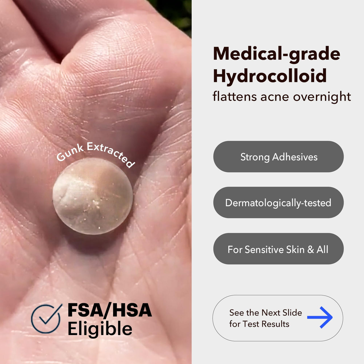 AVARELLE Acne Cover Patches, Eligible Hydrocolloid Pimple Patches for Face with Tea Tree Oil, Korean Skincare Zit Patches for Face | HSA Store Eligible Items | Vegan, Cruelty-free