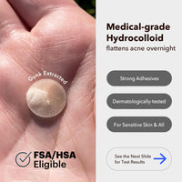 Thumbnail for AVARELLE Acne Cover Patches, Eligible Hydrocolloid Pimple Patches for Face with Tea Tree Oil, Korean Skincare Zit Patches for Face | HSA Store Eligible Items | Vegan, Cruelty-free