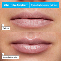 Thumbnail for Dr.Jart+ Vital Hydra Solution Jelly Bear Korean Lip Mask Overnight with Hyaluronic Acid, Clear and Fragrance Free | Korean Skin Care, 0.59 oz.