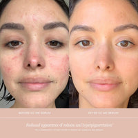 Thumbnail for Summer Fridays CC Me Serum with Vitamin C + Niacinamide - Brightening + Hydrating Face Serum to Improve Skin Tone + Reduce Appearance of Dark Spots Over Time (1 Fl Oz)