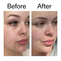 Thumbnail for The INKEY List Omega Water Cream 1.69 fl oz/50ml, Oil-Free Face Moisturiser, Lightweight Gel, Vegan Friendly Skincare, Suitable For Blemish Prone Skin