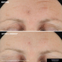 Thumbnail for Kate Somerville KateCeuticals Firming Serum | Advanced Anti-Aging Plumping & Firming Treatment | 1 Fl Oz