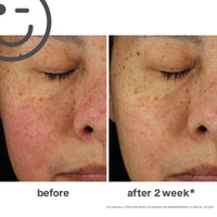 Thumbnail for Kate Somerville KateCeuticals Total Repair Cream | Advanced Anti-Aging Moisturizer | Visibly Reduces Wrinkles & Fine Lines | 0.3 Fl Oz