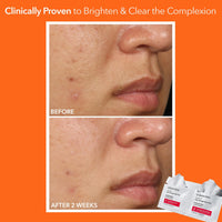 Thumbnail for Dr. Dennis Gross Alpha Beta Extra Strength Daily Peel – 2-Step Exfoliating Pads for Enhanced Anti-Aging, Smoother Skin, and Radiant Complexion, 5 Treatments
