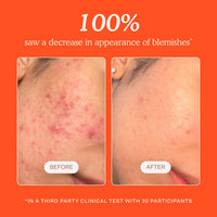 Thumbnail for Tower 28 SOS Daily Rescue Facial Spray - Hypochlorous Acid Spray to Help Reduce Redness, Calm Irritation + Alleviate Flare-Ups - Soothing + Purifying Face Toner - Everyday Skin Care Essential (4 oz)