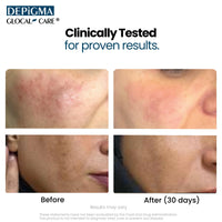 Thumbnail for GlocalCare Depigma Support Reduction of Hyperpigmentation, Melasma & Dark Spots with Glutathione, Polypodium Leucotomos, Grape Seed & Marigold Extract