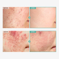 Thumbnail for TOSOWOONG Dexpanthenol Cream, 170,000ppm B5 Panthenol, Madecassoside, Centella Asiatica for Skin Barrier Repair, Facial Moisturizer, Soothing, Hydrating, Korean Skincare, 60ml, 2.02 fl. oz.