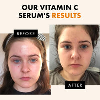 Thumbnail for Eclat Skincare Vitamin C Face Serum - Skin Care for Dark Spots, Vitamin C Serum with Hyaluronic Acid, Ferulic Acid, & Vit E - Anti Aging and Skin Brightening, Pure Vit C Facial Care - 30 ml