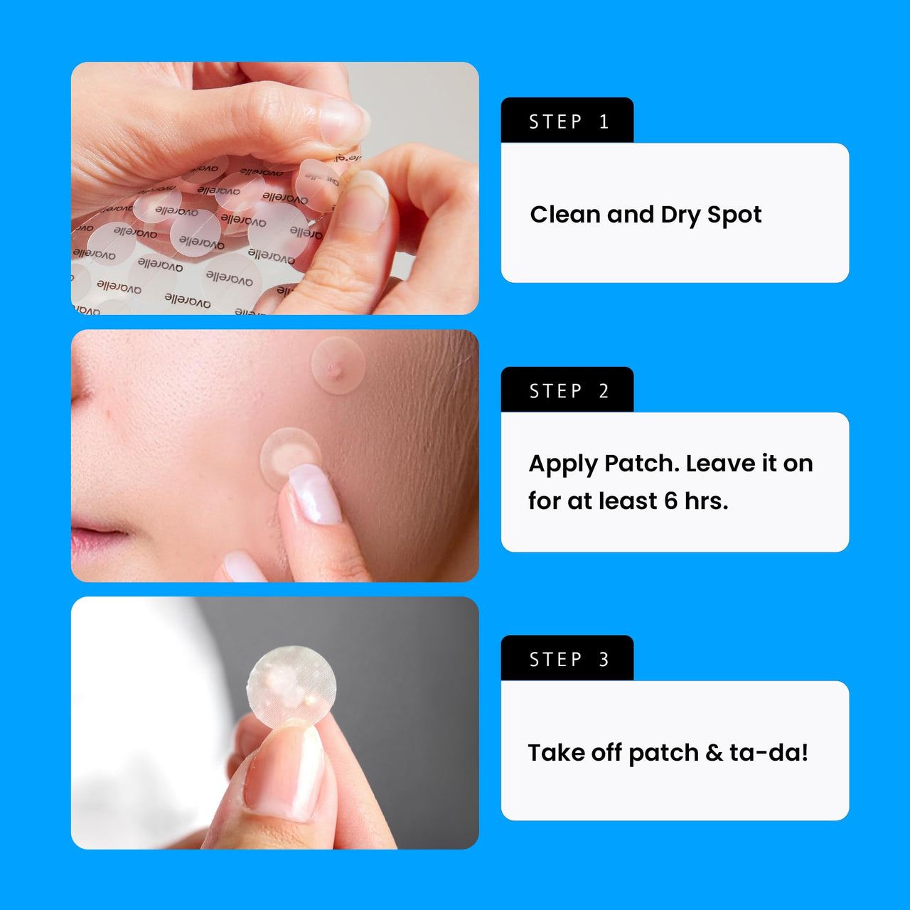 AVARELLE Acne Cover Patches, Eligible Hydrocolloid Pimple Patches for Face with Tea Tree Oil, Korean Skincare Zit Patches for Face | HSA Store Eligible Items | Vegan, Cruelty-free