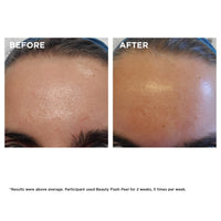 Thumbnail for Clarins Beauty Flash Peel | 10-Minute At-Home Facial | Visibly Tightens Pores | Gently Eliminates Dead Skin Cells | Refines Skin Texture | Renews Radiance | Contains AHAs and BHAs | All Skin Types